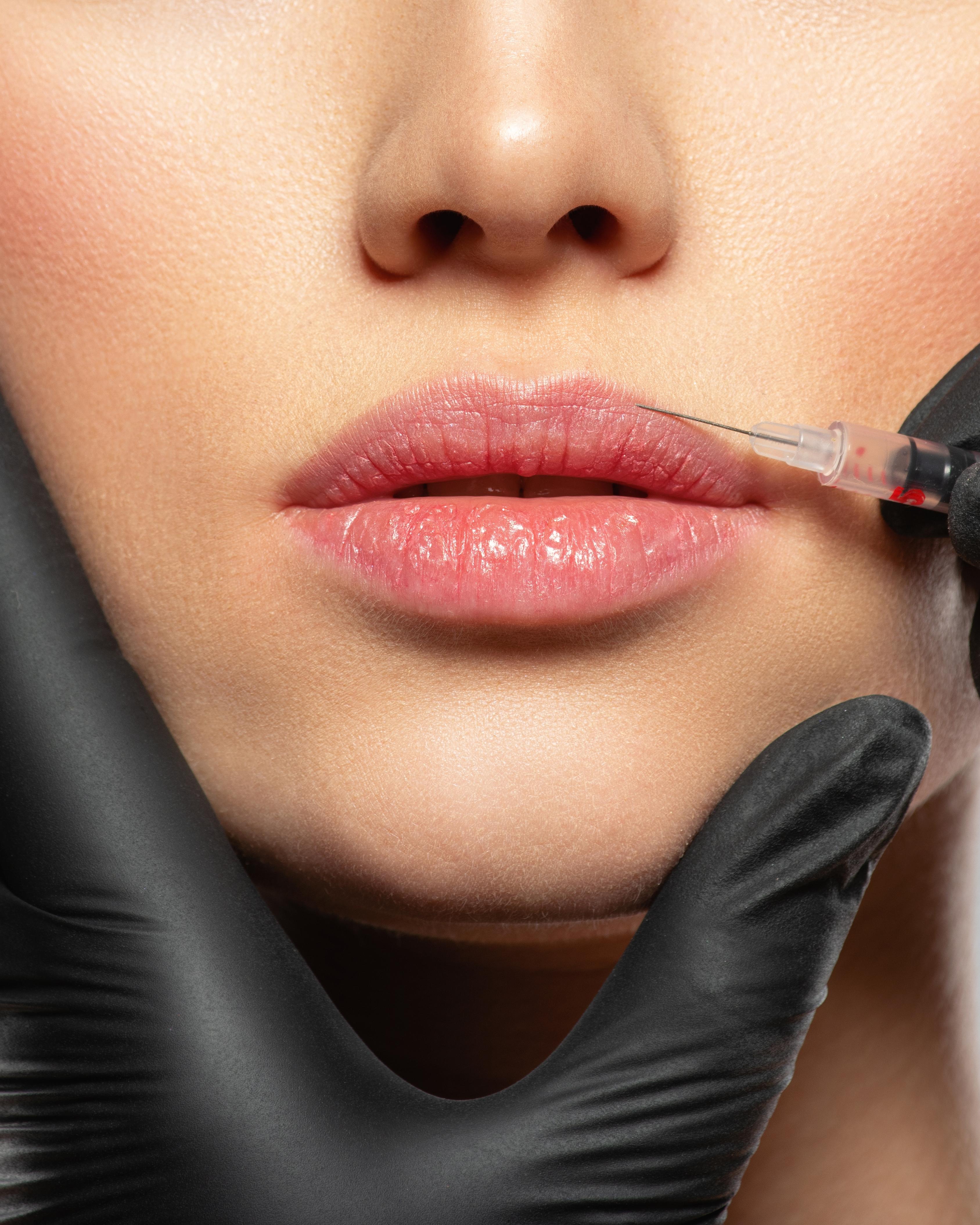 Image related to dermal fillers
